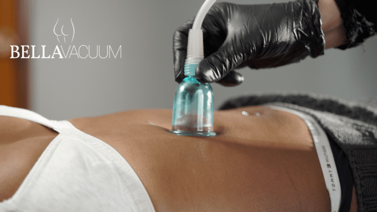 Vacuum Therapy For Weight Loss: Belly Fat & Hip Dips